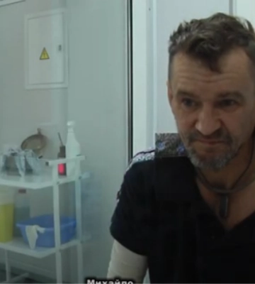 Аби врятувати руку: у Луцьку військовому провели три операції за один раз