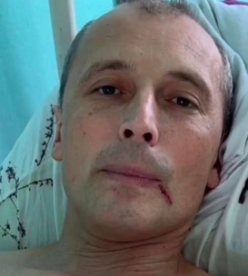 Подорванный гауляйтер из Мелитополя «идет на поправку» - и очень хочет в «единую россию»