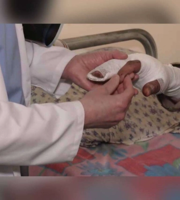Реабілітація поранених: як у Дніпрі відновлюють здоров’я цивільним та військовим