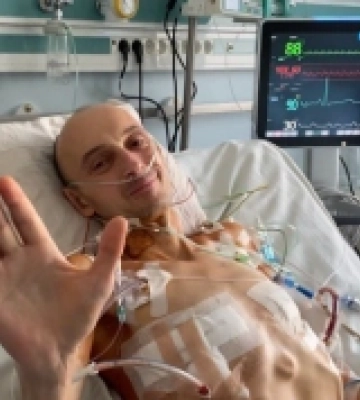 Як почувається чоловік, якому нещодавно пересадили легені від посмертного донора з Нововолинська