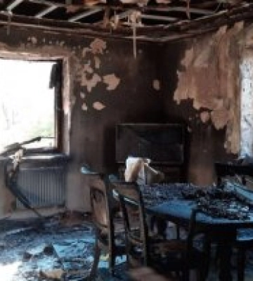 Намагалися самостійно загасити вогонь: у Звягелі на пожежі травмувалося подружжя