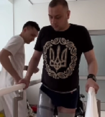До війни працював у Луцьку: воїну, який втратив на війні дві ноги, встановили протези