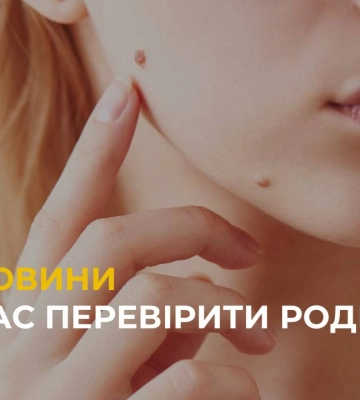 Час перевірити родимки: лікарі у Львові запрошують пройти обстеження на меланому