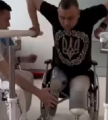 Працював і одружився у Луцьку: воїну, який втратив на війні дві ноги, встановили протези