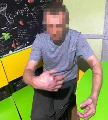 У Києві застільна дискусія сусідів у хостелі закінчилася бійкою та різаниною, - поліція