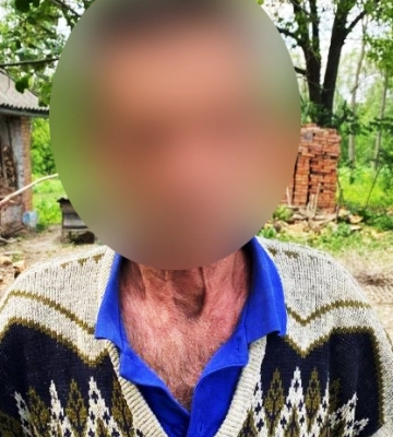 У Вінницькій області чоловік до смерті побив односельця