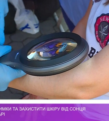 Близько 200 людей перевірили свої родимки під час акції &quot;Перевір підозріле утворення на шкірі, поки не пізно&quot; в Ужгороді