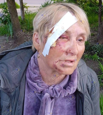 В Кривом Роге пенсионерку столкнули с лестницы, когда та пришла за &quot;гуманитаркой&quot;