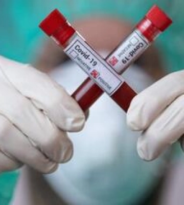 Минулого тижня від ковіду в області померло четверо людей