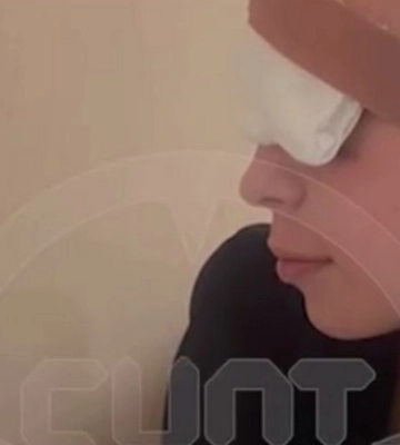 У Криму дівчина ледь не виколола собі око через витівку з тортом