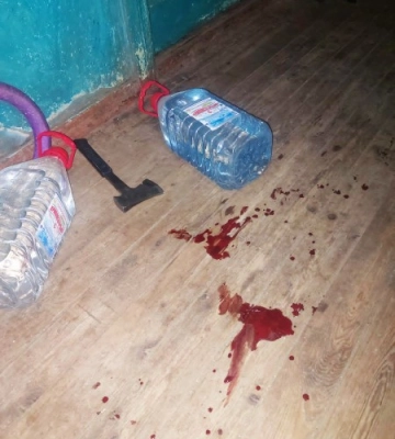 У Миколаєві слідчі оголосили про підозру жінці за посягання на життя поліцейського