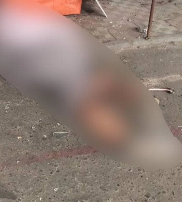 Вранці ворог накрив вогнем зупинку та медзаклад у Харкові: одна людина загинула, 17 – поранені