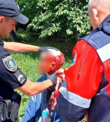 Патрульні врятували чоловіка, який у Дубні впав і стікав кров'ю