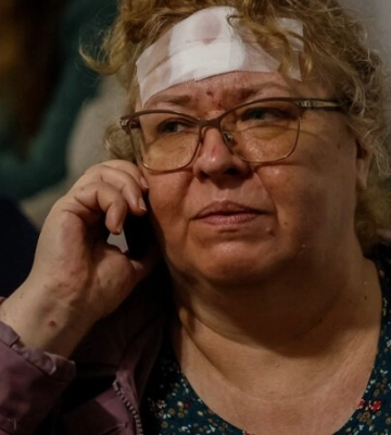 «І вони хочуть перемогти нас?». Жінка, яка постраждала від російської ракети в Кривому Розі, розповіла, як українці допомагали після трагедії