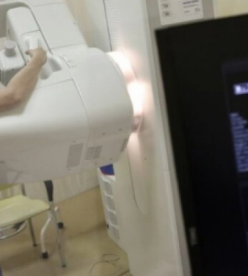 У Львові жінок запрошують зробити мамографію у вихідний день