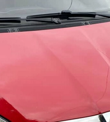 У Сокільниках під колеса авто потрапив 5-річний хлопчик