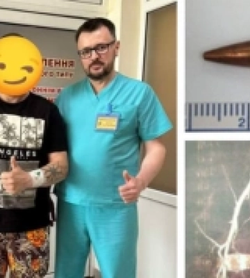 Ворожа куля зупинилась всередині артерії: у Рівному прооперували пораненого захисника