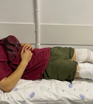 Вибух міни нашпигував ноги цвяхами і гайками: у Львові врятували бійця від ампутації