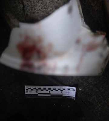 У Києві нападник тяжко травмував чоловіка уламком керамічної раковини (ФОТО)