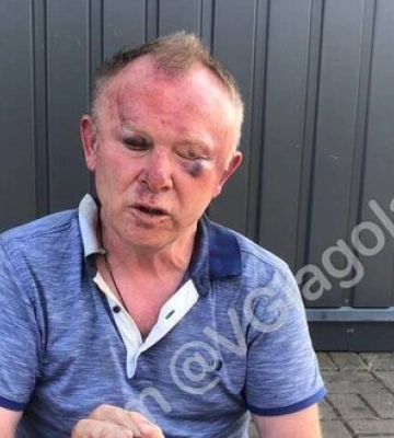 Вивезли в ліс і вибили зуби: на Закарпатті побили генарала СБУ