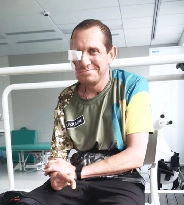 Пережив 68 операцій: у Львові медики відновили обличчя захисникові (ФОТО)