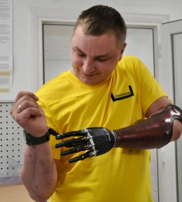 Кермує мотоциклом з двома протезами: у Львові воїну встановили біонічну руку