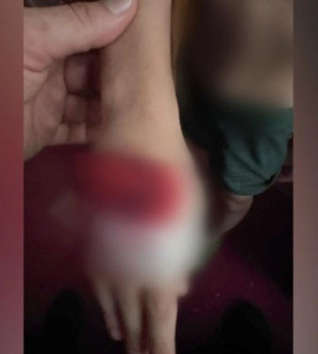 В Полтавской области задержали мужчину по подозрению в пытках детей сожительницы