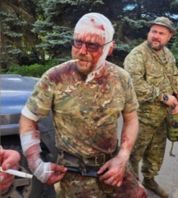 Ексватажок «ДНР» Бородай потрапив під обстріл на Донбасі