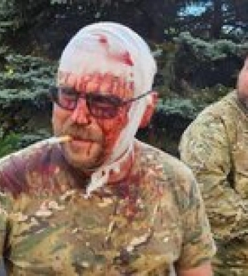 Одного из главарей оккупантов на Донбассе посекло осколками под Бахмутом. Пока жив – фото