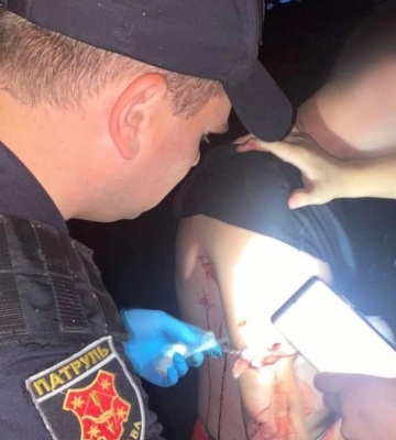 У Полтаві невідомий вдарив чоловіка ножем