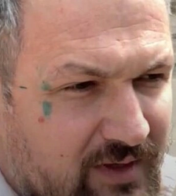 Три титушки напали на экс-нардепа Левченко, борющегося со &quot;строительной мафией&quot;, - Лерос. ФОТО