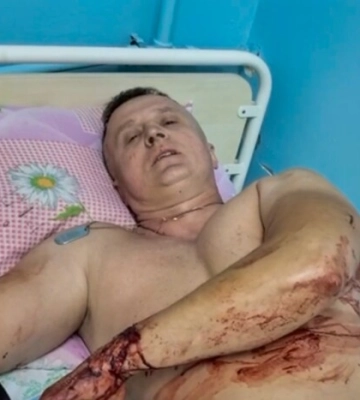 Удар по Покровску: среди раненых - герой фильма &quot;20 дней в Мариуполе&quot;