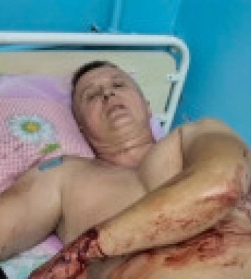 В Покровске под обстрел попал полицейский, герой фильма &quot;20 дней в Мариуполе&quot;