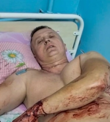 Серед поранених у Покровську - герой фільму 20 днів у Маріуполі