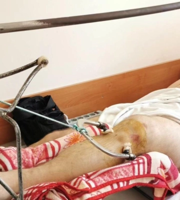 Полтавська родина, яка постраждала від вибуху газу в будинку, потребує допомоги