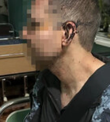 В воинской части избили армейца, говорит, это сделал ответственный по в/ч – ГБР