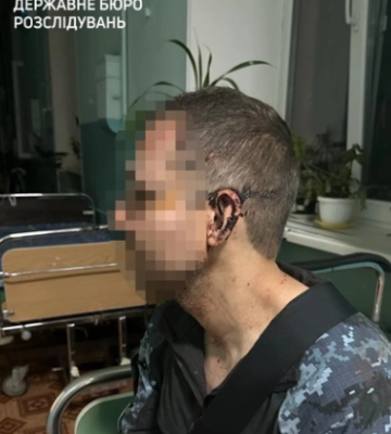 В одній із військових частин на Одещині побили військового: ДБР почала розслідування