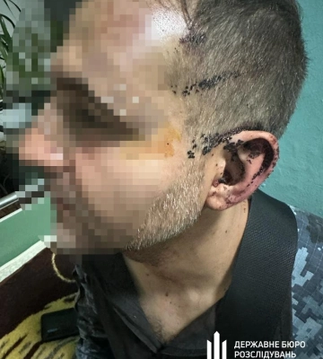 В одній із військових частин на Одещині побили військового: ДБР почала розслідування
