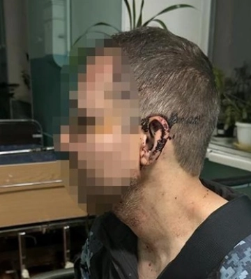 На Одещині у військовій частині побили бійця