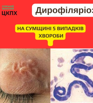 На Сумщині – 5 випадків дирофіляріозу, що передається через укуси комарів