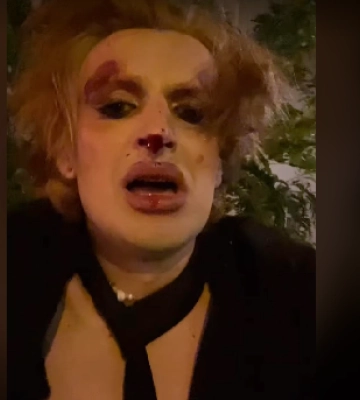 У центрі Львова побили трансгендерну військову