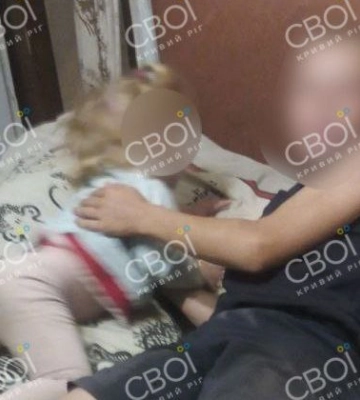 В Кривом Роге у малолетнего мальчика в руках взорвалась батарейка