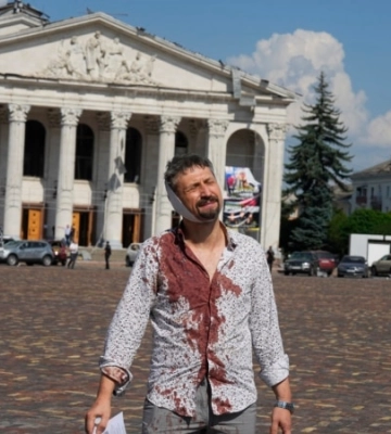 Терміново до Києва з Чернігова транспортують 12-річну дівчинку, яка постраждала від російської ракети (Відео)