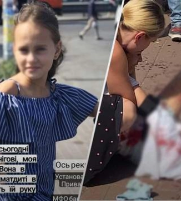 Лікарі борються за руку дитини. Що відомо про стан 12-річної дівчинки, яку терміново доправили в Київ після удару по Чернігову
