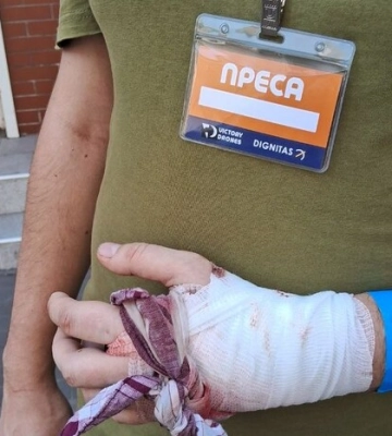 Ракетна атака по Чернігову: внаслідок удару постраждала родина журналістів