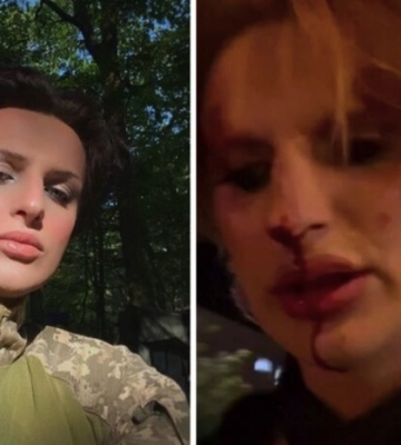 У побитті трансгендерної військової підозрюють 22-річного чоловіка — прокуратура Львівщини