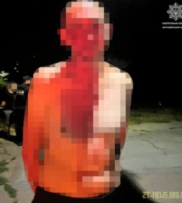 У Житомирі на Польовій затримали двох чоловіків: один гуляв по вулиці з ножем, інший – крав мідні кабелі
