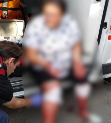 Под Киевом собака напала на женщину: пострадавшую госпитализировали