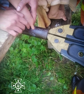 На Львівщині рятувальники вивільнили палець 7-річної дитини з отвору у возі