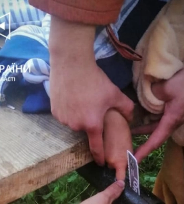 На Львівщині у 7-річної дитини палець застряг у конструкціях возу – довелося викликати ДСНС, фото